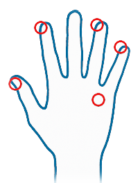 Illustration, rechte Hand mit eingezeichneten Akupunkturpunkten